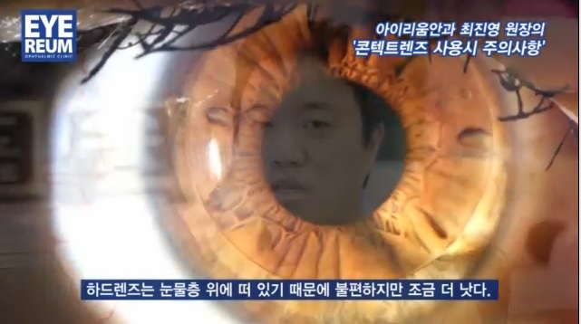 라식과 콘텍트렌즈 - 최진영 원장
