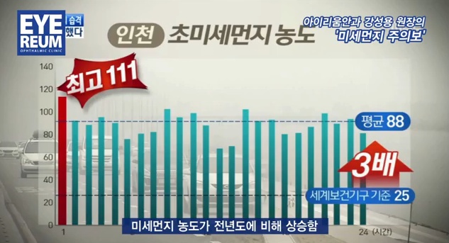 미세먼지 주의보 - 강성용 원장