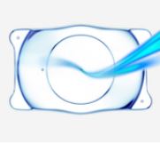 렌즈삽입술 Q&A, 네이버 지식in 상담사례