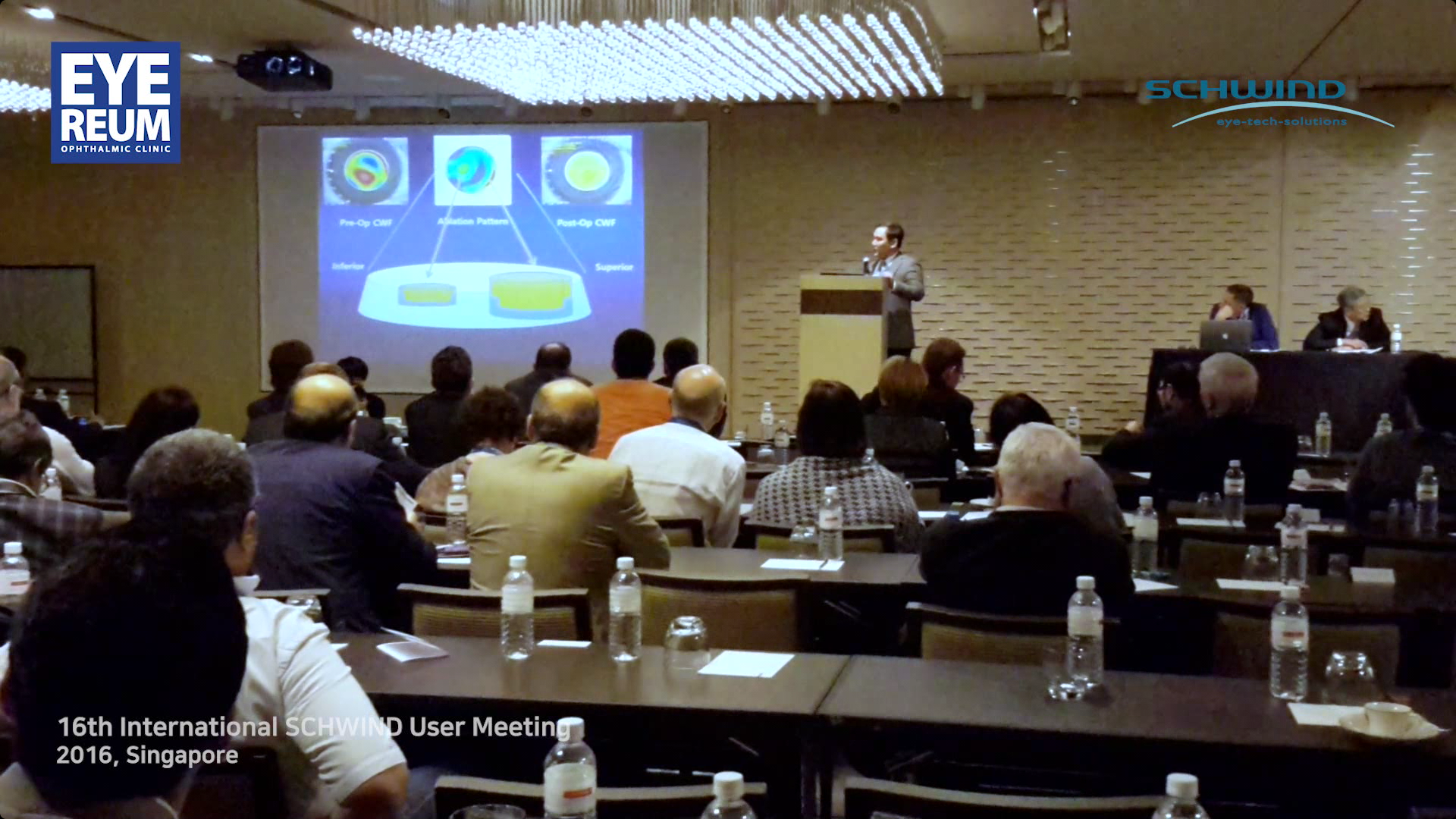 [2016 AMARIS] Keratoconus Customization