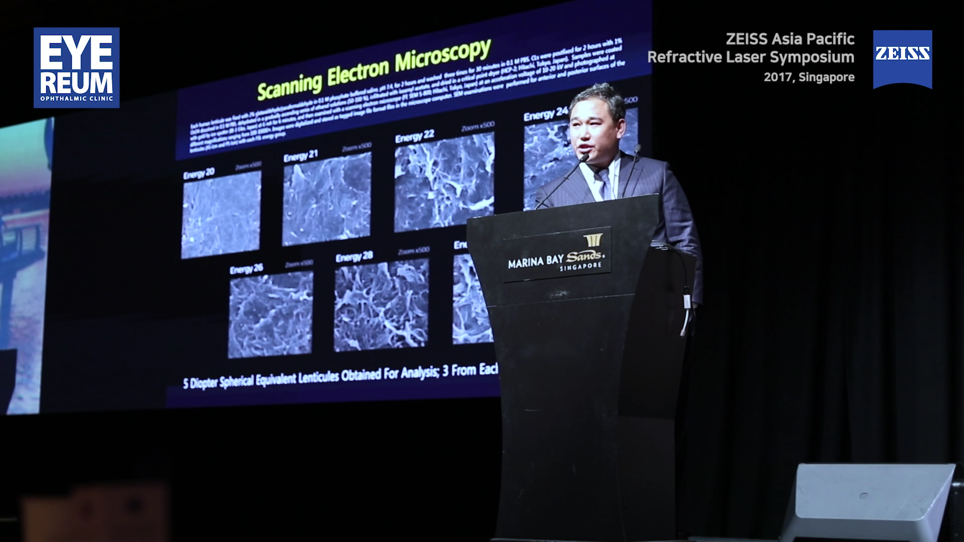 [2017 ZEISS] Aberrations and SMILE