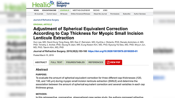 [Paper] New paper about SMILE treatment is published on JRS!