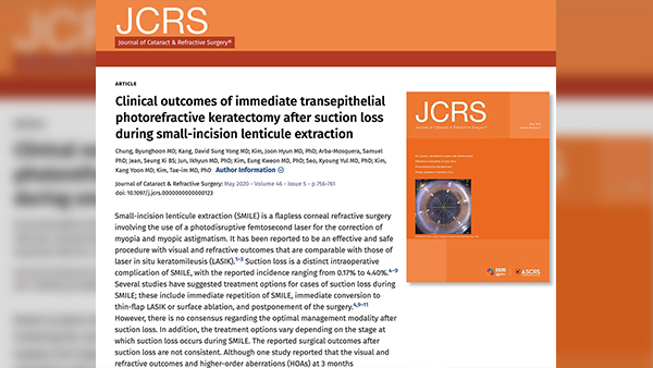 [논문] 스마일수술 석션로스 시 올레이저라섹 수술의 안전성과 효과 연구