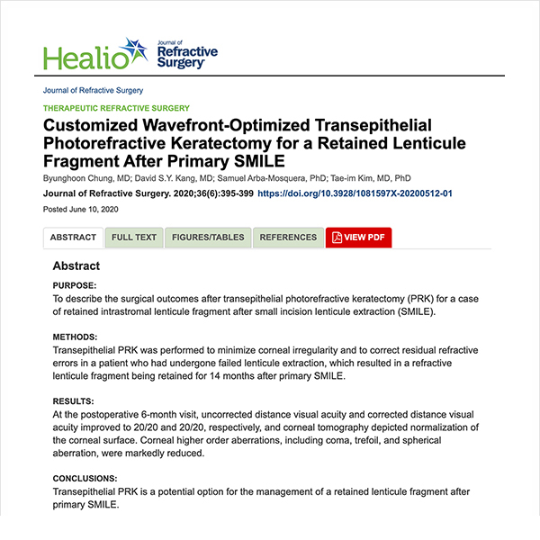 [논문] 스마일수술  후 코웨이브라섹으로 재수술 임상결과