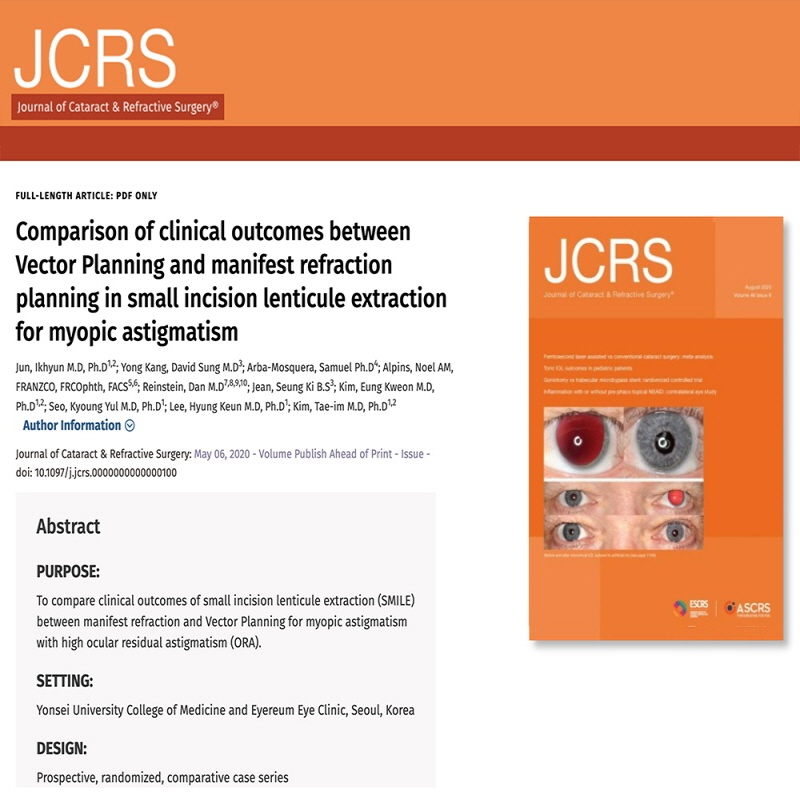 [논문] 스마일수술 안구잔여난시 감소시키는 Vector Planning