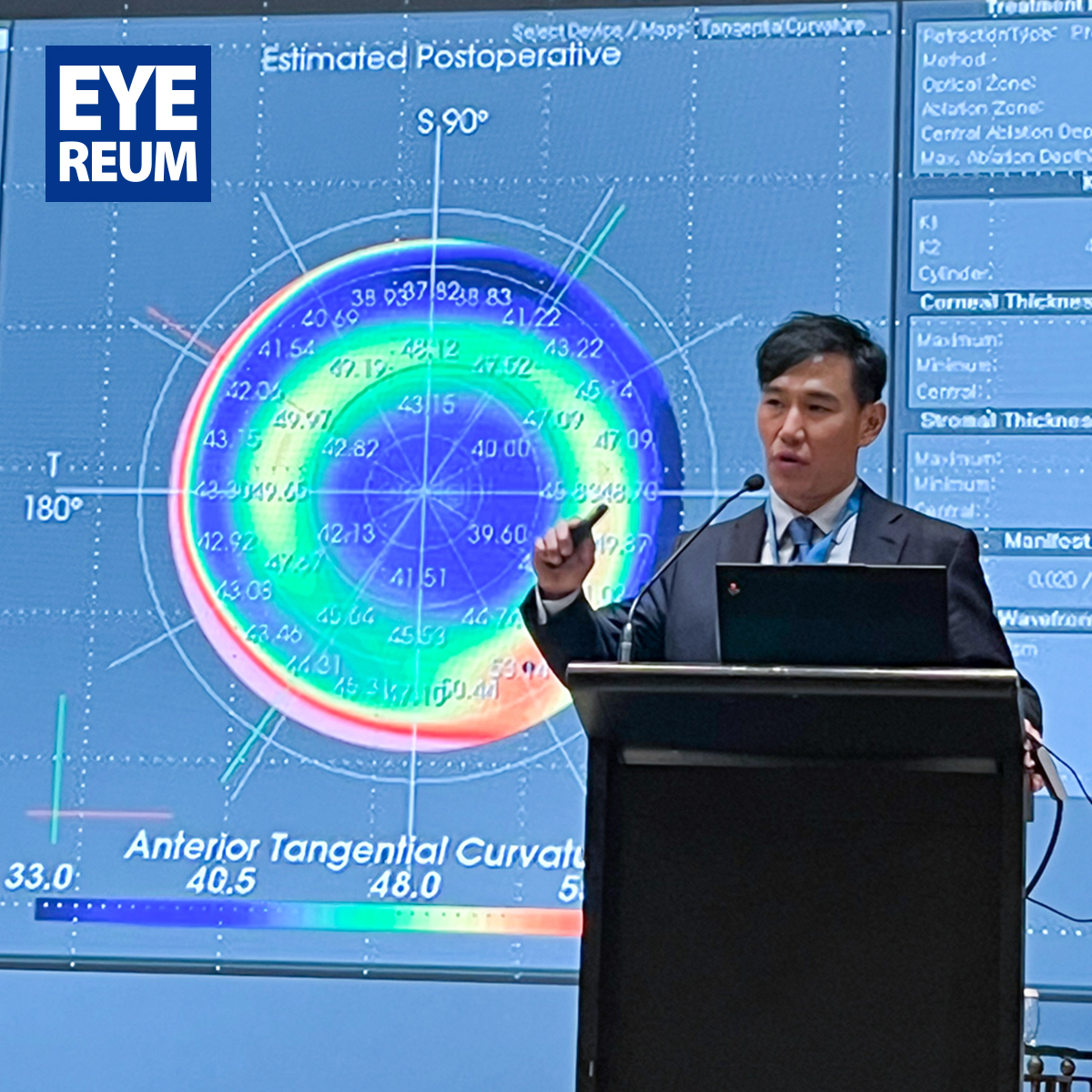 프레즈비맥스 노안수술과 라식 후 노안교정 전략, 플라즈마 스마일 초청강연_강성용원장(방콕학회)