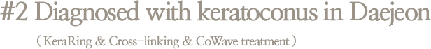 #2 Diagnosed with keratoconus in Daejeon ( KeraRing & Cross-linking & CoWave treatment )