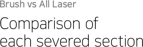 Brush vs All Laser Comparison of each severed section
