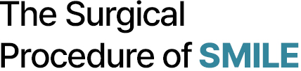 The Surgical Procedure of SMILE