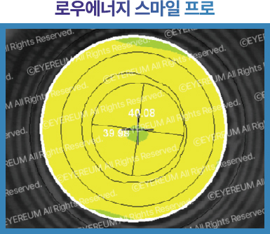 로우에너지 스마일 프로