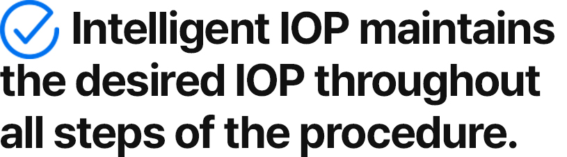 Intelligent IOP maintains the desired IOP throughout all steps of the procedure.