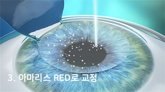 3. 아마리스 RED로 교정