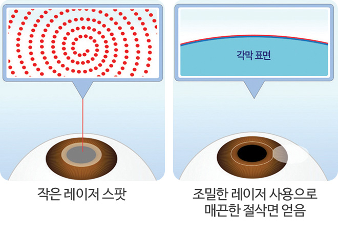 자이스 렌즈의 작은 레이저 빔