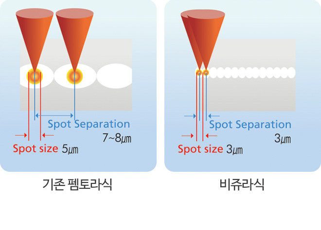 낮은 에너지로 합병증 완화