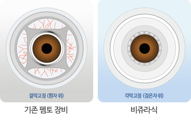 기존 펨토 장비/비쥬라식