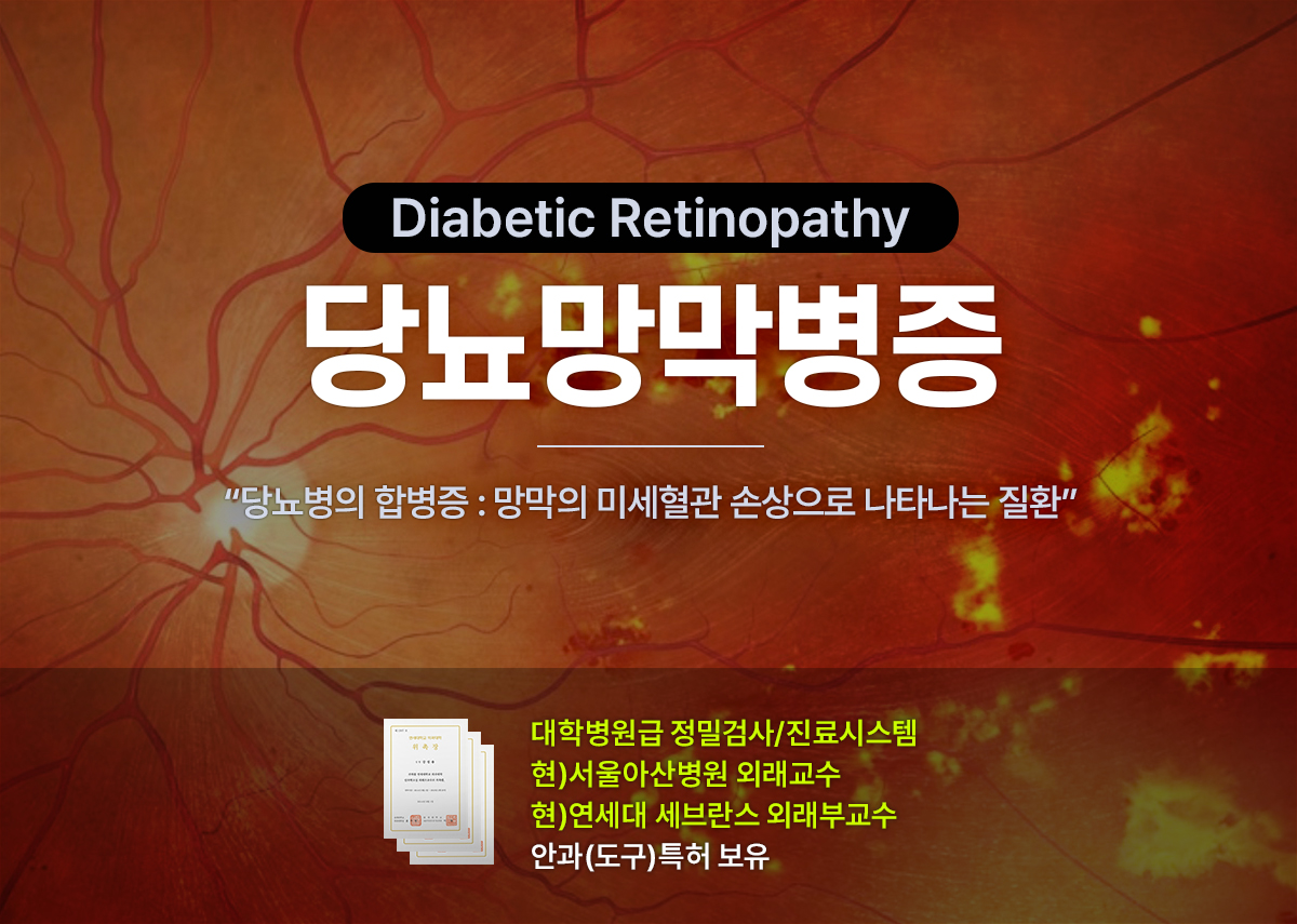 당뇨망막병증